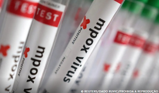 Sobe para 140 número de casos confirmados de Mpox no país, em 2026