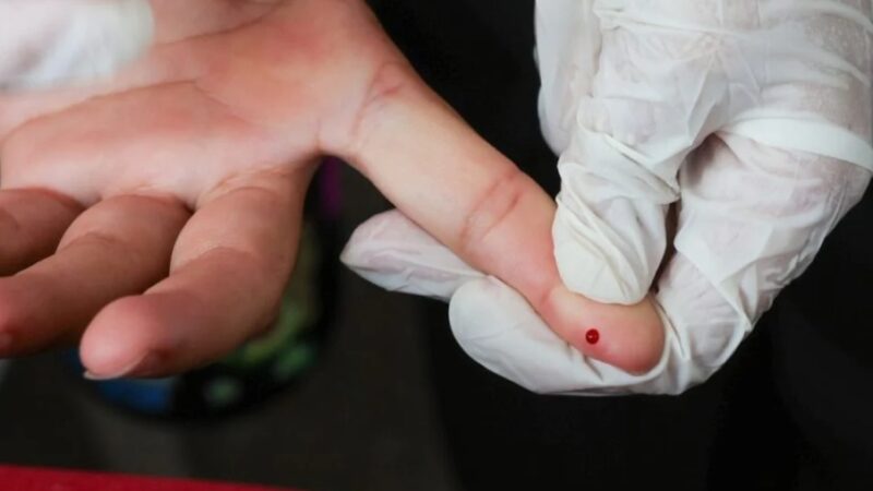 SUS passa a oferecer teste rápido para dengue; exame permite diagnóstico antes da fase aguda da doença