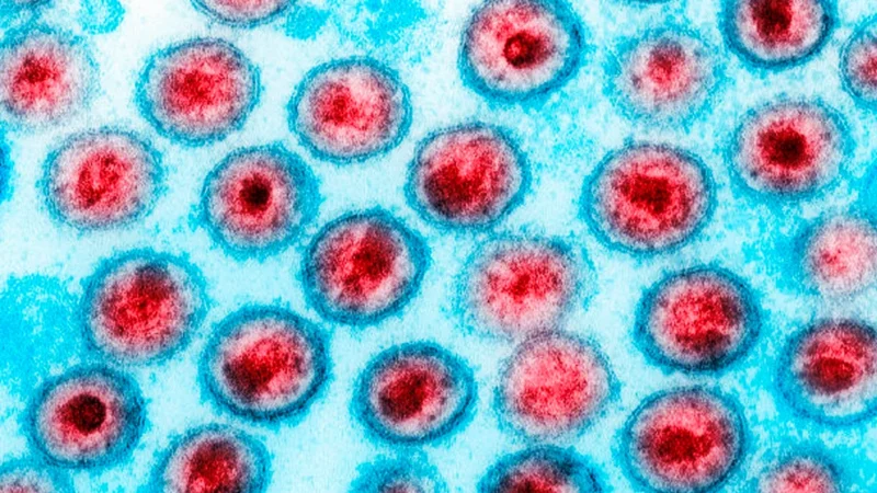 Cientistas anunciam dois novos casos de possível cura do HIV; total chega a 13 no mundo