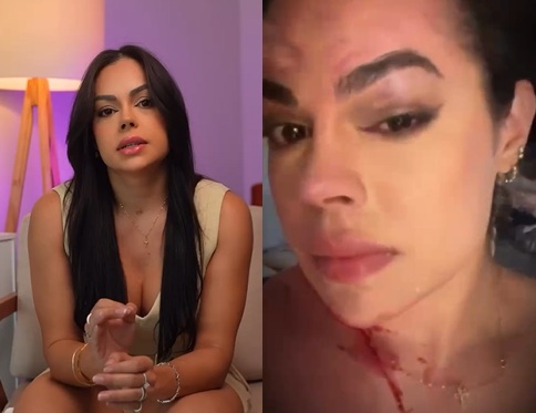 Ex-primeira-dama de Granito quebra o silêncio e relata grave agressão dentro de casa